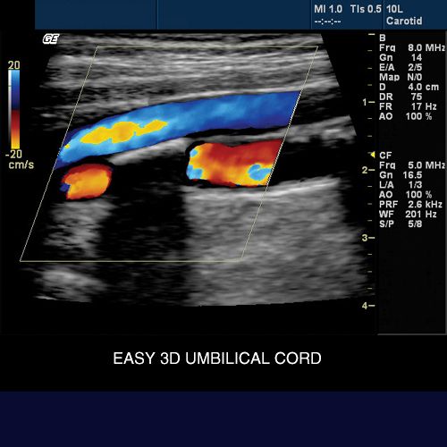 GE Logiq 5 + 2 Probes   used Ultrasound  